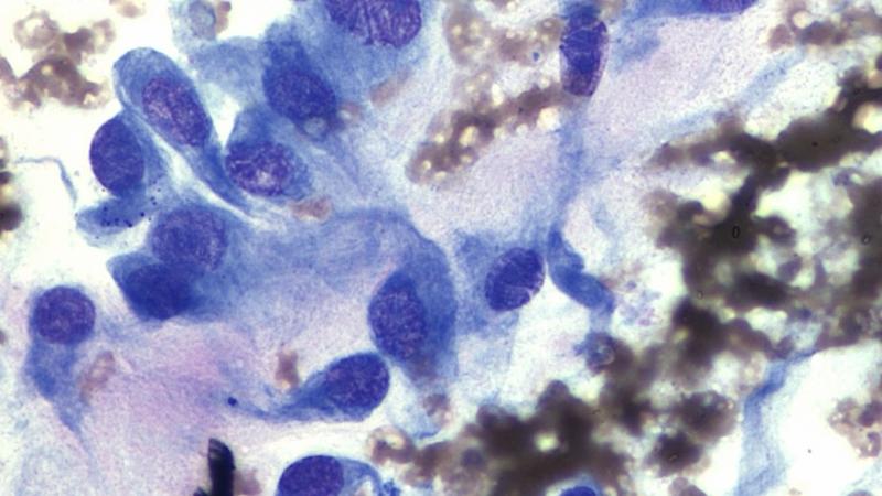 Featured image for Cytology Post